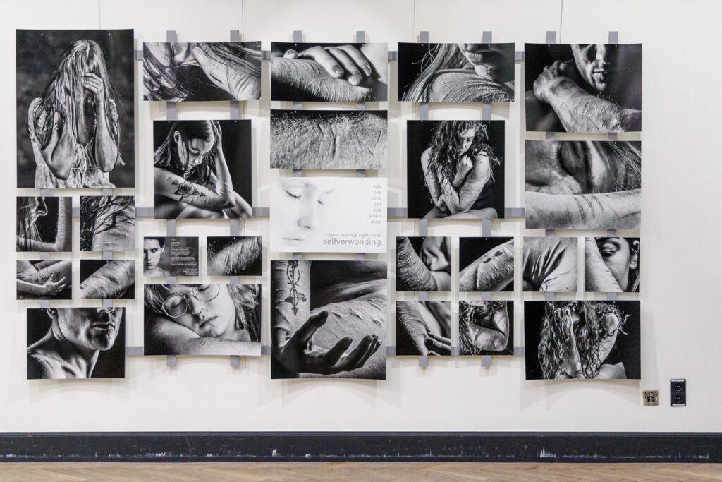 Reeks zelfverwonding Robert Biesemans